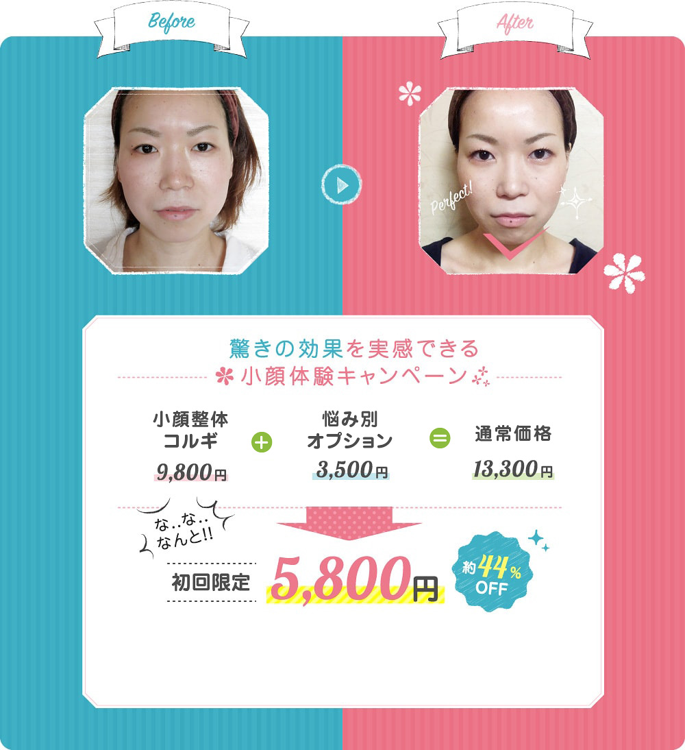 小顔体験キャンペーン