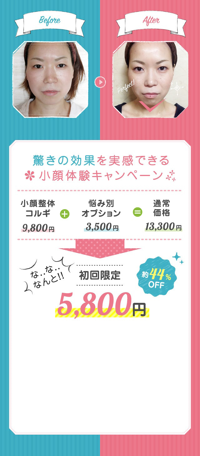 小顔体験キャンペーン