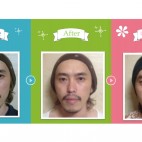 男性モニター様 比較写真