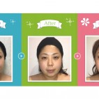 本気の小顔モニター3